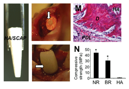 Exposed Tooth Root. generated tooth root and